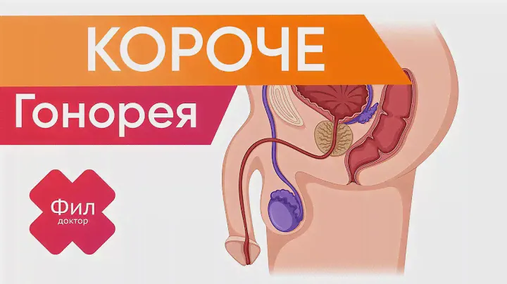 ГОНОРЕЯ Лечение | КОРОТКО | Как вылечить гонорею дома за 1 минуту | Симптомы | Как быстро вылечить